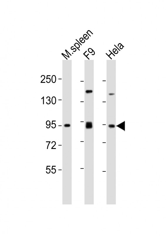 SUZ12 Antibody - All lanes : Anti-SUZ12 Antibody at 1:2000 dilution Lane 1: mouse spleen lysates Lane 2: F9 whole cell lysates Lane 3: HeLa whole cell lysates Lysates/proteins at 20 ug per lane. Secondary Goat Anti-Rabbit IgG, (H+L), Peroxidase conjugated at 1/10000 dilution Predicted band size : 83 kDa Blocking/Dilution buffer: 5% NFDM/TBST.