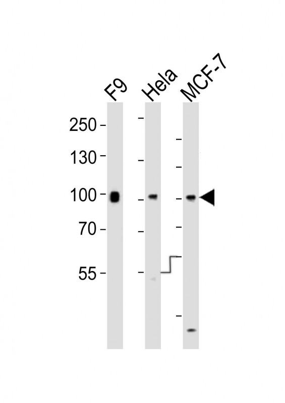 SUZ12 Antibody - All lanes : Anti-Suz12 Antibody at 1:1000 dilution Lane 1: F9 whole cell lysates Lane 2: HeLa whole cell lysates Lane 3: MCF-7 whole cell lysates Lysates/proteins at 20 ug per lane. Secondary Goat Anti-Rabbit IgG, (H+L), Peroxidase conjugated at 1/10000 dilution Predicted band size : 83 kDa Blocking/Dilution buffer: 5% NFDM/TBST.