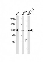 SUZ12 Antibody - All lanes : Anti-Suz12 Antibody at 1:1000 dilution Lane 1: F9 whole cell lysates Lane 2: HeLa whole cell lysates Lane 3: MCF-7 whole cell lysates Lysates/proteins at 20 ug per lane. Secondary Goat Anti-Rabbit IgG, (H+L), Peroxidase conjugated at 1/10000 dilution Predicted band size : 83 kDa Blocking/Dilution buffer: 5% NFDM/TBST.