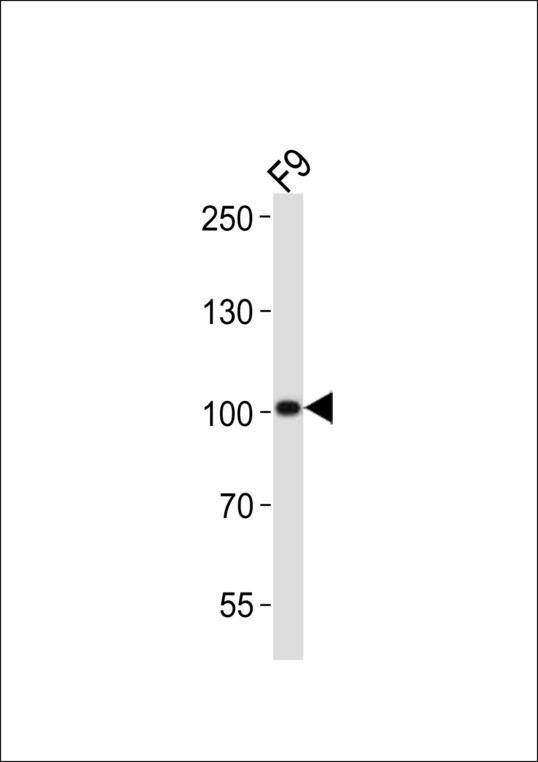 SUZ12 Antibody - Western blot of lysate from mouse F9 cell line, using Suz12 antibody diluted at 1:1000. A goat anti-rabbit IgG H&L (HRP) at 1:10000 dilution was used as the secondary antibody. Lysate at 20 ug.
