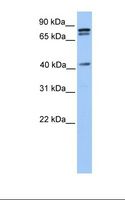 SUZ12 Antibody - 721_B cell lysate. Antibody concentration: 1.0 ug/ml. Gel concentration: 12%.  This image was taken for the unconjugated form of this product. Other forms have not been tested.