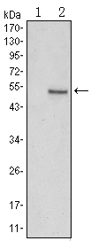 SUZ12 Antibody - Western blot using SUZ12 monoclonal antibody against HEK293 (1) and SUZ12(AA: 533-739)-hIgGFc transfected HEK293 (2) cell lysate.