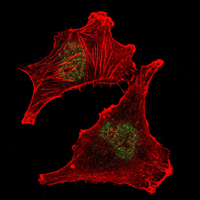 SUZ12 Antibody - Immunofluorescence of U251 cells using SUZ12 mouse monoclonal antibody (green). Red: Actin filaments have been labeled with Alexa Fluor-555 phalloidin.