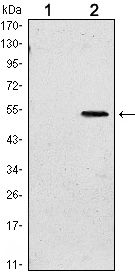SUZ12 Antibody - SUZ12 Antibody in Western Blot (WB)