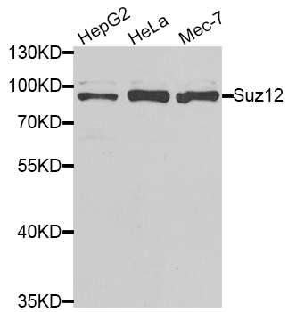 SUZ12 Antibody - Western blot analysis of extracts of various cell lines.