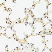 SUZ12 Antibody - Immunohistochemistry of paraffin-embedded rat lung tissue.