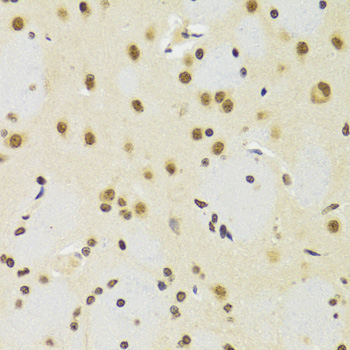 SUZ12 Antibody - Immunohistochemistry of paraffin-embedded rat brain tissue.