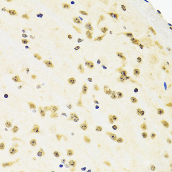SUZ12 Antibody - Immunohistochemistry of paraffin-embedded mouse brain tissue.