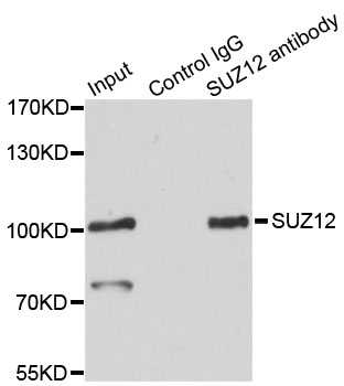 SUZ12 Antibody - Immunoprecipitation analysis of 200ug extracts of HeLa cells.