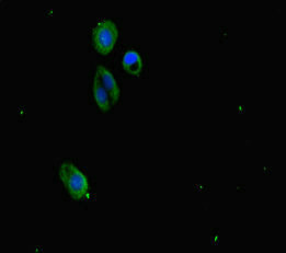 SUZ12 Antibody - Immunofluorescent analysis of HepG-2 cells diluted at 1:100 and Alexa Fluor 488-congugated AffiniPure Goat Anti-Rabbit IgG(H+L)