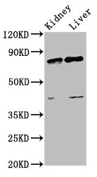 SUZ12 Antibody - Western Blot Positive WB detected in:Rat kidney tissue,Rat liver tissue All Lanes:SUZ12 antibody at 3.4µg/ml Secondary Goat polyclonal to rabbit IgG at 1/50000 dilution Predicted band size: 84 KDa Observed band size: 84 KDa