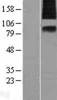 SV2A / SV Protein - Western validation with an anti-DDK antibody * L: Control HEK293 lysate R: Over-expression lysate