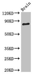 SV2B Antibody - Western Blot Positive WB detected in: Mouse brain tissue All lanes: SV2B antibody at 3.4µg/ml Secondary Goat polyclonal to rabbit IgG at 1/50000 dilution Predicted band size: 78, 61 kDa Observed band size: 78 kDa