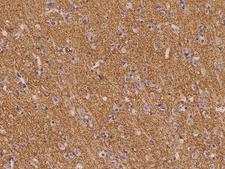 SV2B Antibody - Immunochemical staining of human Sv2b in human brain with rabbit polyclonal antibody at 1:300 dilution, formalin-fixed paraffin embedded sections.