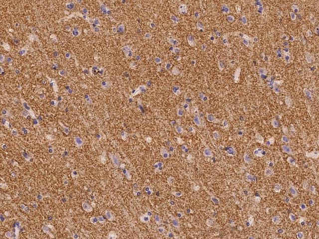 SV2B Antibody - Immunochemical staining of human Sv2b in human brain with rabbit polyclonal antibody at 1:300 dilution, formalin-fixed paraffin embedded sections.