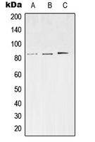 SV2C Antibody - Western blot analysis of SV2C expression in SKNSH (A); Neuro2A (B); PC12 (C) whole cell lysates.