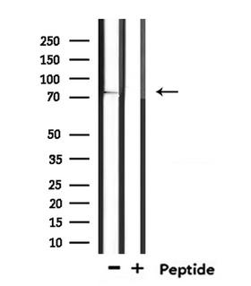 SV2C Antibody - Western blot analysis of extracts of mouse lung using SV2C antibody.