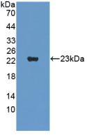 SVIL / Supervillin Antibody - Western Blot; Sample: Recombinant SVIL, Human.