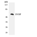 SVOP Antibody - Western blot analysis of the lysates from Jurkat cells using SVOP antibody.