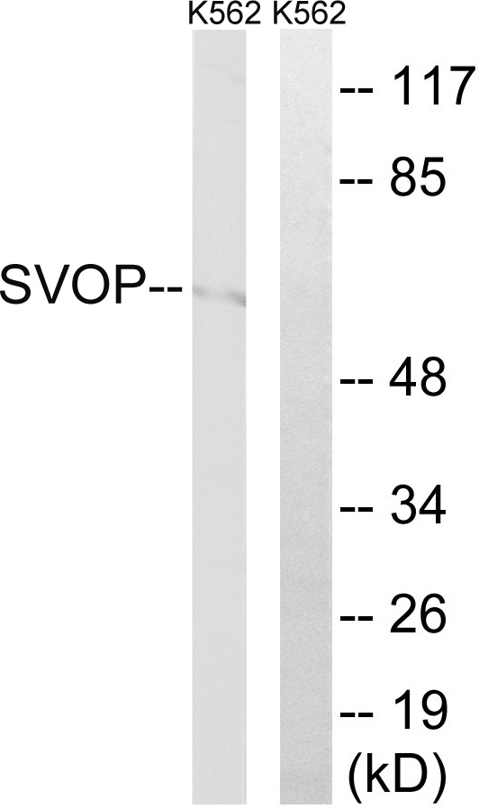 SVOP Antibody - Western blot analysis of lysates from K562 cells, using SVOP Antibody. The lane on the right is blocked with the synthesized peptide.