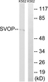 SVOP Antibody - Western blot analysis of lysates from K562 cells, using SVOP Antibody. The lane on the right is blocked with the synthesized peptide.