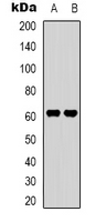 SVOP Antibody - Western blot analysis of SVOP expression in HepG2 (A); K562 (B) whole cell lysates.