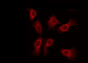 SVOP Antibody - Staining HeLa cells by IF/ICC. The samples were fixed with PFA and permeabilized in 0.1% Triton X-100, then blocked in 10% serum for 45 min at 25°C. The primary antibody was diluted at 1:200 and incubated with the sample for 1 hour at 37°C. An Alexa Fluor 594 conjugated goat anti-rabbit IgG (H+L) Ab, diluted at 1/600, was used as the secondary antibody.