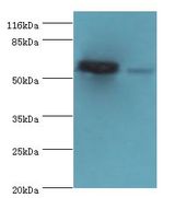SVOPL Antibody - Western blot. All lanes: SVOPL antibody at 2 ug/ml Lane 1:mouse liver tissue. Lane 2: rat liver tissue. Secondary antibody: Goat polyclonal to rabbit at 1:10000 dilution. Predicted band size: 54 kDa. Observed band size: 54 kDa.  This image was taken for the unconjugated form of this product. Other forms have not been tested.
