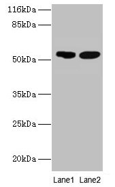 SVOPL Antibody - Western blot All lanes: SVOPL antibody at 2µg/ml Lane 1: Mouse liver tissue Lane 2: Rat liver tissue Secondary Goat polyclonal to rabbit IgG at 1/10000 dilution Predicted band size: 54, 37 kDa Observed band size: 54 kDa