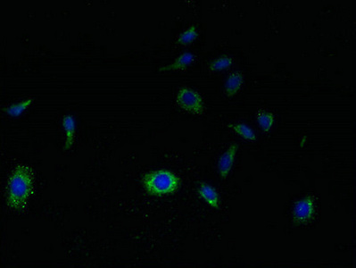 SVOPL Antibody - Immunofluorescent analysis of HepG2 cells using SVOPL Antibody at dilution of 1:100 and Alexa Fluor 488-congugated AffiniPure Goat Anti-Rabbit IgG(H+L)