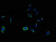 SVOPL Antibody - Immunofluorescent analysis of HepG2 cells using SVOPL Antibody at dilution of 1:100 and Alexa Fluor 488-congugated AffiniPure Goat Anti-Rabbit IgG(H+L)