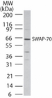 SWAP70 Antibody - Western blot of SWAP-70 in Daudi cell lysate using antibody at 2 ug/ml.