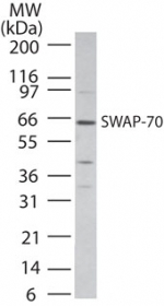 SWAP70 Antibody - Western blot of SWAP-70 in Daudi cell lysate using antibody at 2 ug/ml.