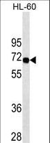 SWAP70 Antibody - SWAP70 Antibody western blot of HL-60 cell line lysates (35 ug/lane). The SWAP70 antibody detected the SWAP70 protein (arrow).