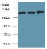 SWAP70 Antibody - Western blot. All lanes: SWAP70 antibody at 10 ug/ml. Lane 1: NIH/3T3 whole cell lysate. Lane 2: HepG-2 whole cell lysate. Lane 3: Raji whole cell lysate. Secondary antibody: Goat polyclonal to Rabbit IgG at 1:10000 dilution. Predicted band size: 69 kDa. Observed band size: 69 kDa.
