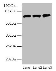 SWAP70 Antibody - Western blot All lanes: SWAP70 antibody at 10µg/ml Lane 1: NIH/3T3 whole cell lysate Lane 2: HepG2 whole cell lysate Lane 3: Raji whole cell lysate Secondary Goat polyclonal to rabbit IgG at 1/10000 dilution Predicted band size: 69 kDa Observed band size: 69 kDa