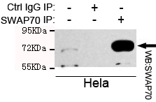 SWAP70 Antibody - Immunoprecipitation analysis of HeLa cell lysate using SWAP70 mouse monoclonal antibody.