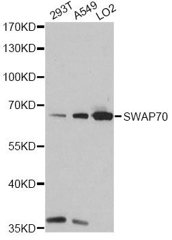 SWAP70 Antibody - Western blot analysis of extracts of various cell lines, using SWAP70 antibody at 1:1000 dilution. The secondary antibody used was an HRP Goat Anti-Rabbit IgG (H+L) at 1:10000 dilution. Lysates were loaded 25ug per lane and 3% nonfat dry milk in TBST was used for blocking. An ECL Kit was used for detection and the exposure time was 5s.