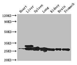 SWI5 / C9orf119 Antibody - Positive WB detected in:Mouse heart tissue,Mouse liver tissue,Mouse spleen tissue,Mouse lung tissue,Mouse kidney tissue,Mouse brain tissue,Mouse stomach tissue;All lanes: SWI5 antibody at 3ug/ml;Secondary;Goat polyclonal to rabbit IgG at 1/50000 dilution;Predicted band size: 27 kDa;Observed band size: 27,29 kDa;
