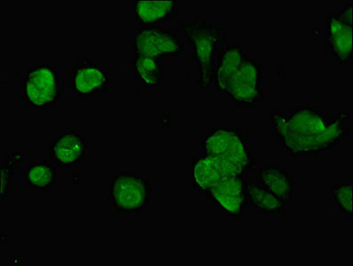 SWI5 / C9orf119 Antibody - Immunofluorescent analysis of MCF-7 cells using SWI5 Antibody at dilution of 1:100 and Alexa Fluor 488-congugated AffiniPure Goat Anti-Rabbit IgG(H+L)