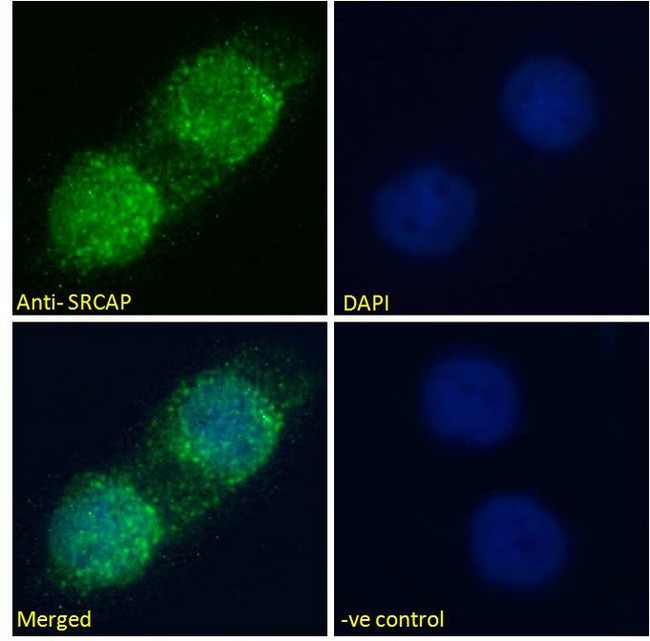 SWR1 / SRCAP Antibody - Goat Anti-SRCAP Antibody Immunofluorescence analysis of paraformaldehyde fixed A431 cells, permeabilized with 0.15% Triton. Primary incubation 1hr (10ug/ml) followed by Alexa Fluor 488 secondary antibody (2ug/ml), showing nuclear staining. The nuclear stain is DAPI (blue). Negative control: Unimmunized goat IgG (10ug/ml) followed by Alexa Fluor 488 secondary antibody (2ug/ml).