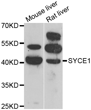 SYCE1 Antibody - Western blot analysis of extracts of various cell lines.