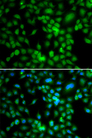 SYCE1 Antibody - Immunofluorescence analysis of MCF7 cells.