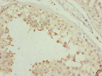 SYCE1 Antibody - Immunohistochemistry of paraffin-embedded human testis tissue at dilution 1:100