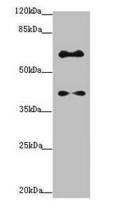 SYCE1 Antibody - Western blot All Lanes: SYCE1 antibody at 1.14ug/ml+ Mouse liver tissue Goat polyclonal to rabbit at 1/10000 dilution Predicted band size: 40,33,22 kDa Observed band size: 40 kDa,58 kDa