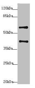 SYCE1 Antibody - Western blot All Lanes: SYCE1 antibody at 3.38ug/ml+ Mouse liver tissue Goat polyclonal to rabbit at 1/10000 dilution Predicted band size: 40,33,22 kDa Observed band size: 40 kDa,58 kDa