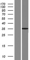 SYCE1L Protein - Western validation with an anti-DDK antibody * L: Control HEK293 lysate R: Over-expression lysate