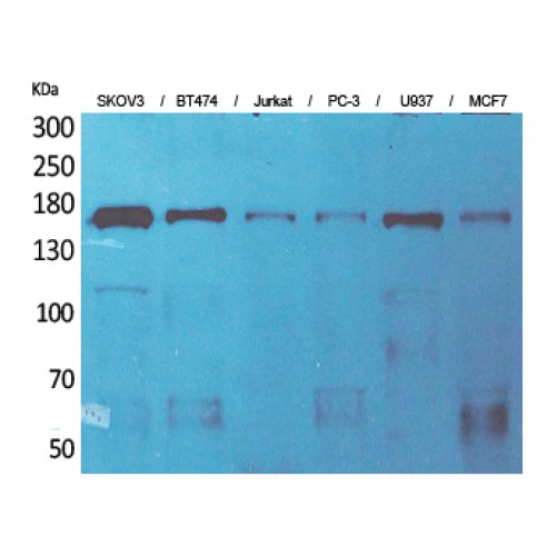 SYCP2 / SCP-2 Antibody - Western blot of SCP-2 antibody