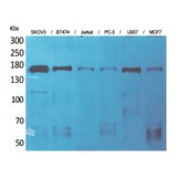 SYCP2 / SCP-2 Antibody - Western blot of SCP-2 antibody