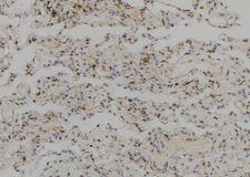 SYCP2 / SCP-2 Antibody - 1:100 staining human lung tissue by IHC-P. The sample was formaldehyde fixed and a heat mediated antigen retrieval step in citrate buffer was performed. The sample was then blocked and incubated with the antibody for 1.5 hours at 22°C. An HRP conjugated goat anti-rabbit antibody was used as the secondary.